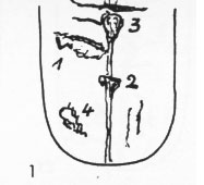 Zungenbild