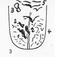 Zungenbild