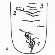 Zungenbild