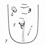 Zungenbild