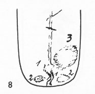 Zungenbild