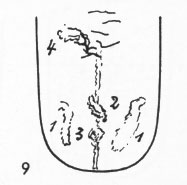 Zungenbild