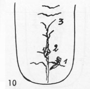 Zungenbild