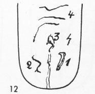 Zungenbild