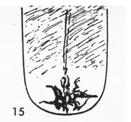 Zungenbild