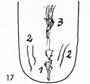 Zungenbild
