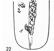 Zungenbild