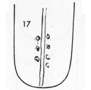 Die Zungen-Topographie der Verdauungsorgane