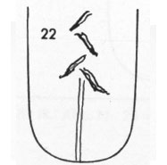 Die Zungen-Topographie der Verdauungsorgane