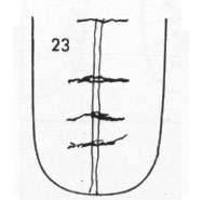 Die Zungen-Topographie der Verdauungsorgane
