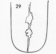 Die Zungen-Topographie der Verdauungsorgane