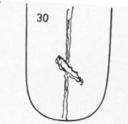 Die Zungen-Topographie der Verdauungsorgane