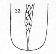 Die Zungen-Topographie der Verdauungsorgane