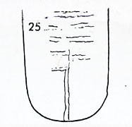 Die Zungen-Topographie der Verdauungsorgane