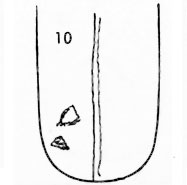 Die Zungen-Topographie der Verdauungsorgane