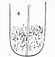 Die Zungen-Topographie der Verdauungsorgane