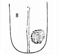 Die Zungen-Topographie der Verdauungsorgane